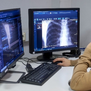 Собянин: Москвичи смогут быстро получать заключение после рентгена благодаря ИИ