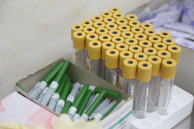 Иммунитет к COVID-19 нашли у 12 процентов обследованных на антитела москвичей